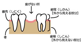 インプラント治療前の処置