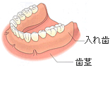 入れ歯